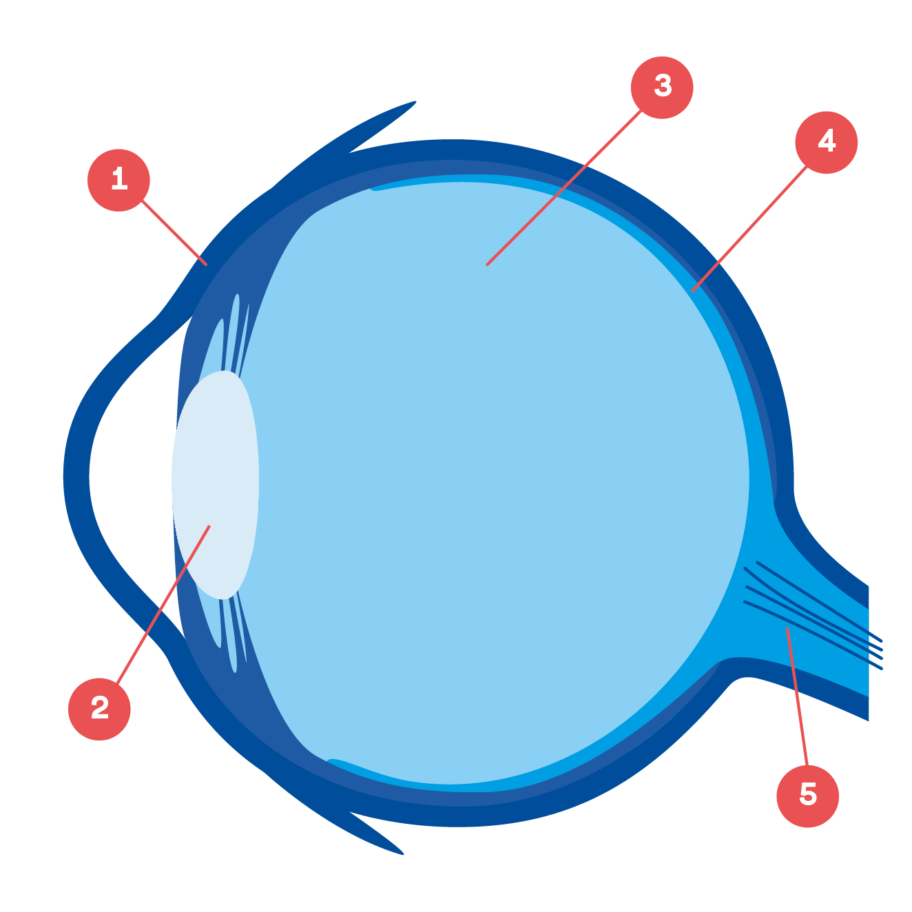 Illustration retinoblastom 